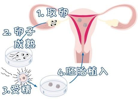 沪上生殖医学中心